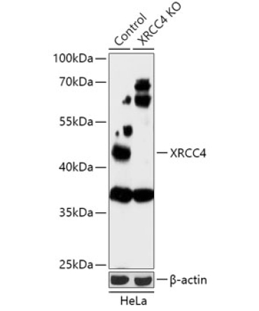 XRCC4 Rabbit Polyclonal Antibody [KO Validated]