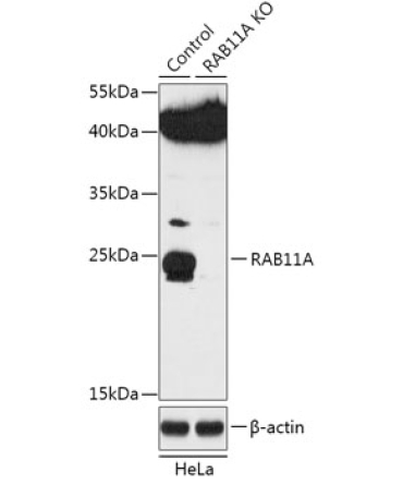RAB11A Rabbit Polyclonal Antibody [KO Validated]