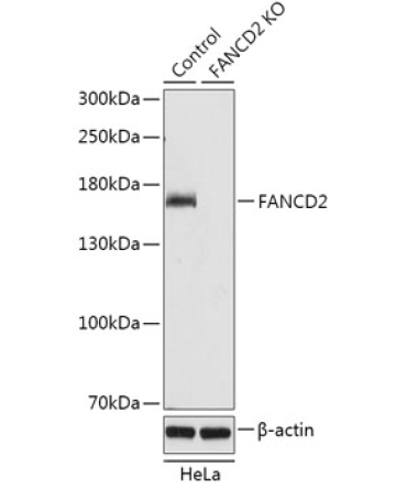 FANCD2 Rabbit Polyclonal Antibody [KO Validated]