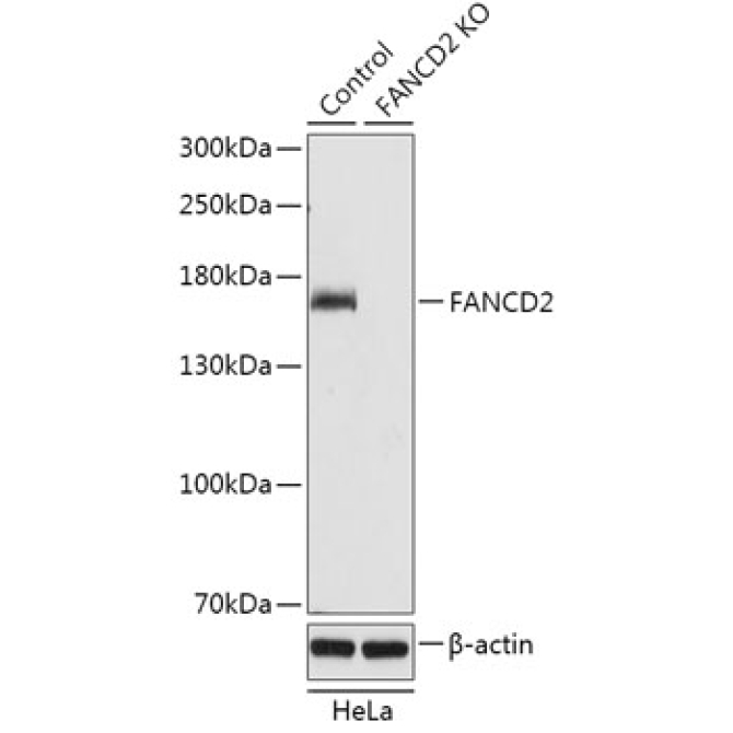 FANCD2 Rabbit Polyclonal Antibody [KO Validated]