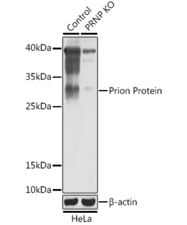 Prion Protein Rabbit Polyclonal Antibody [KO Validated]