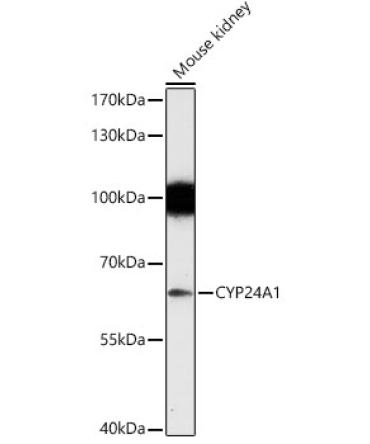 CYP24A1 Rabbit Polyclonal Antibody