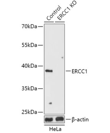 ERCC1 Rabbit Polyclonal Antibody [KO Validated]