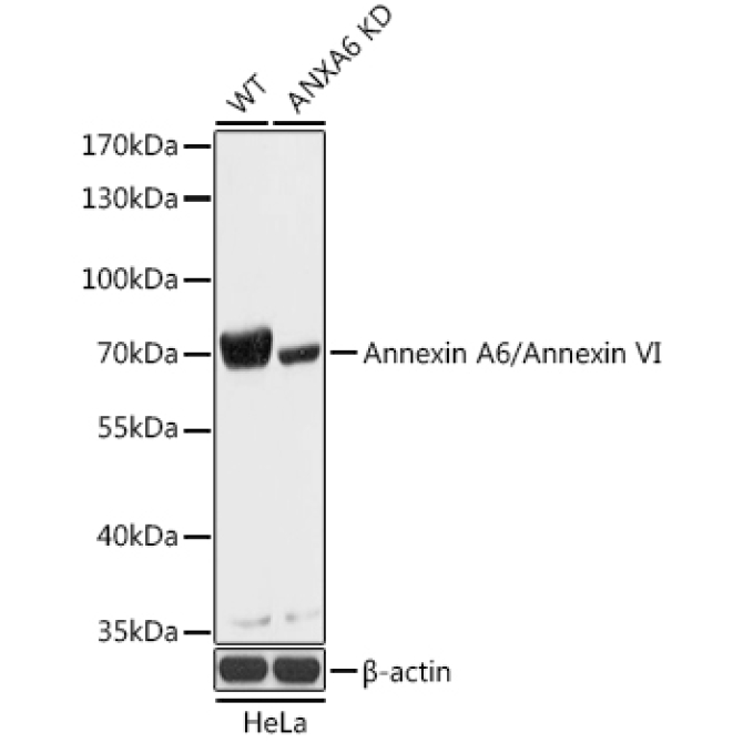 Annexin A6/Annexin VI Rabbit Polyclonal Antibody [KO Validated]