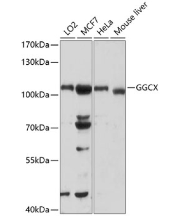 GGCX Rabbit Polyclonal Antibody