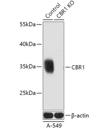 CBR1 Rabbit Polyclonal Antibody [KO Validated]
