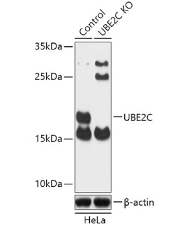 UBE2C Rabbit Polyclonal Antibody [KO Validated]