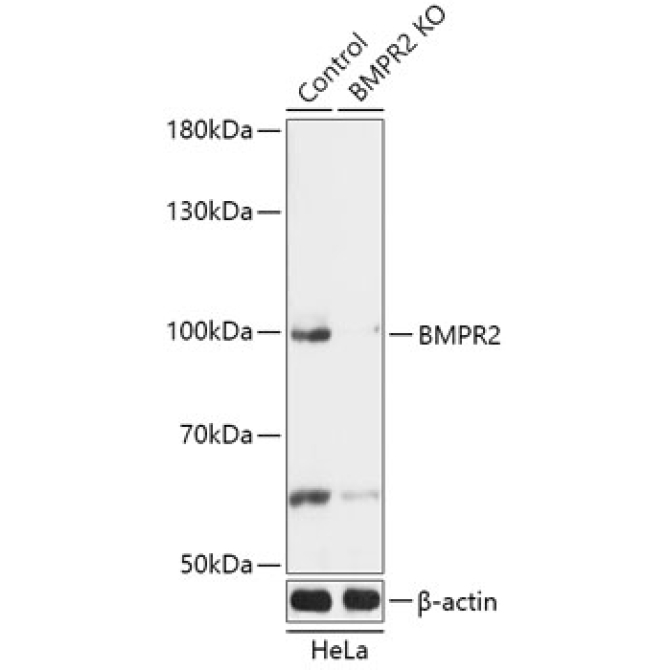 BMPR2 Rabbit Polyclonal Antibody [KO Validated]
