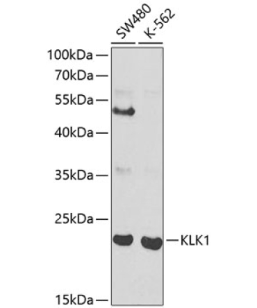 KLK1 Rabbit Polyclonal Antibody