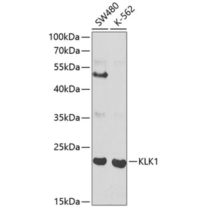 KLK1 Rabbit Polyclonal Antibody