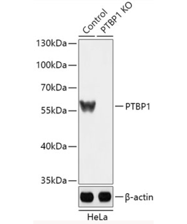 PTBP1 Rabbit Polyclonal Antibody [KO Validated]