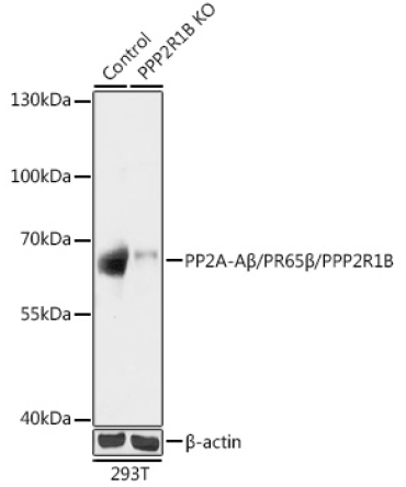 PP2A-ABeta/PR65Beta/PPP2R1B Rabbit Polyclonal Antibody [KO Validated]
