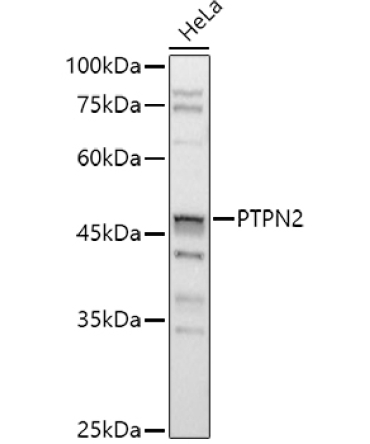PTPN2 Rabbit Polyclonal Antibody [KO Validated]