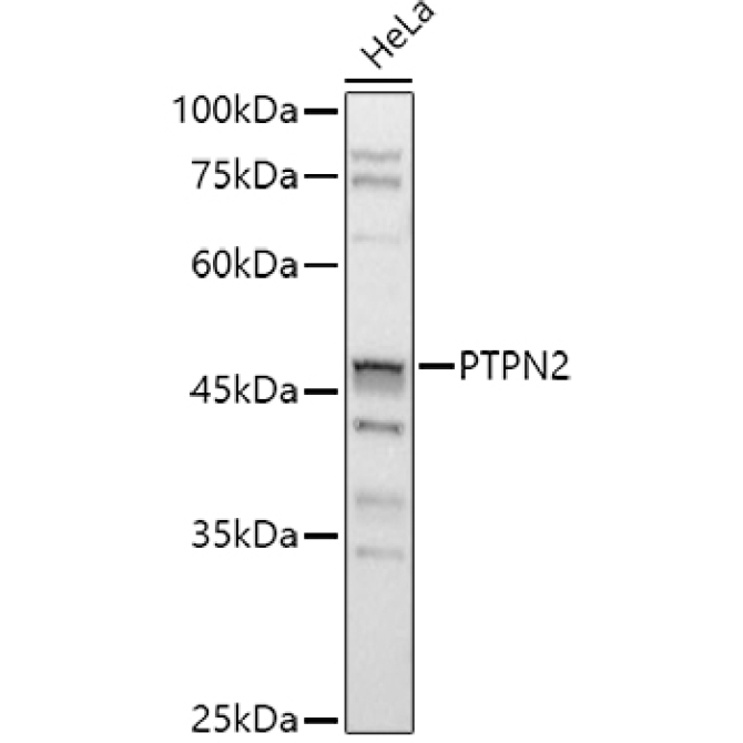 PTPN2 Rabbit Polyclonal Antibody [KO Validated]