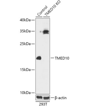 TMED10 Rabbit Polyclonal Antibody [KO Validated]
