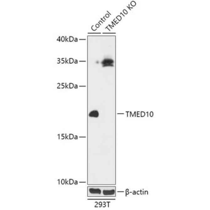 TMED10 Rabbit Polyclonal Antibody [KO Validated]
