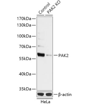 PAK2 Rabbit Polyclonal Antibody [KO Validated]