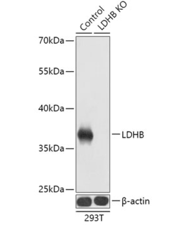 LDHB Rabbit Polyclonal Antibody [KO Validated]