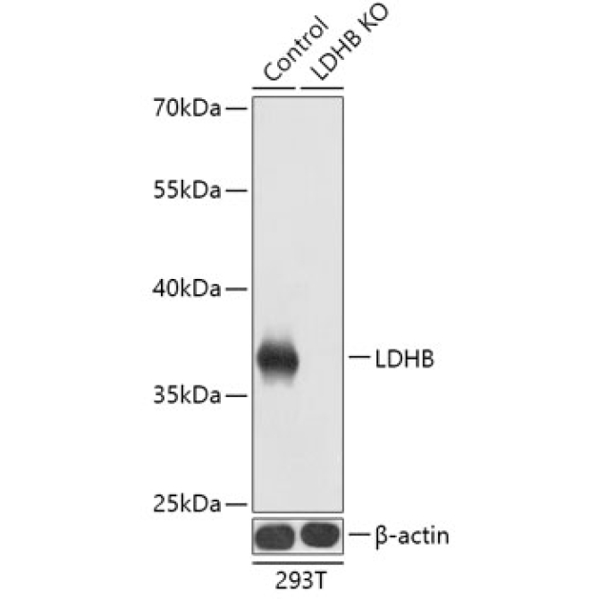 LDHB Rabbit Polyclonal Antibody [KO Validated]