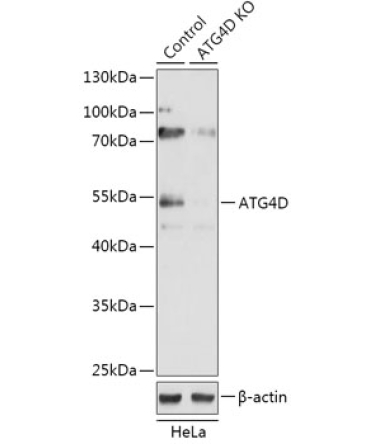ATG4D Rabbit Polyclonal Antibody [KO Validated]