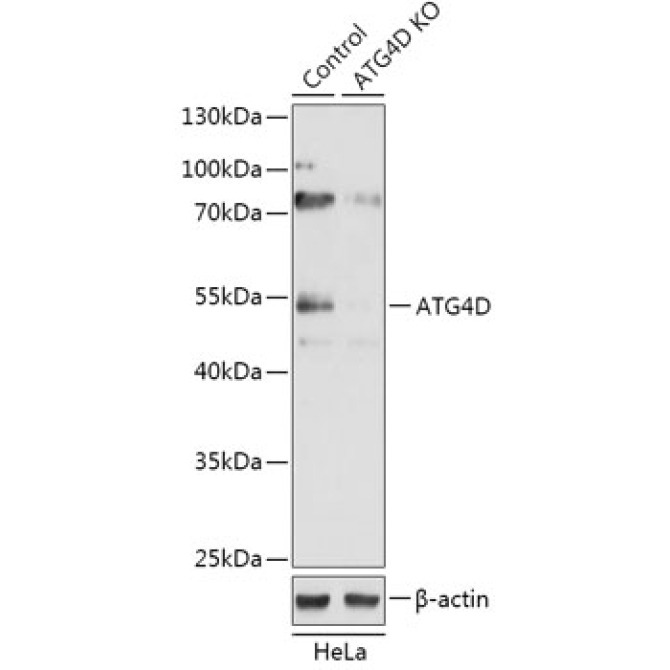 ATG4D Rabbit Polyclonal Antibody [KO Validated]
