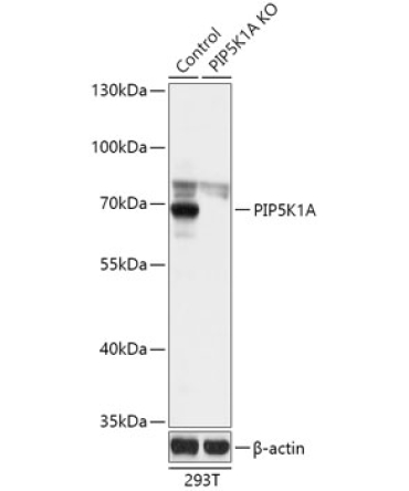 PIP5K1A Rabbit Polyclonal Antibody [KO Validated]