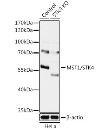 MST1/STK4 Rabbit Polyclonal Antibody [KO Validated]
