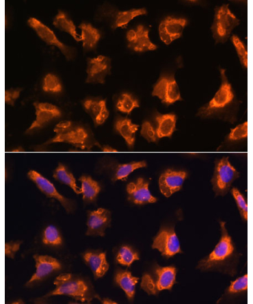 OBSCN Rabbit Polyclonal Antibody