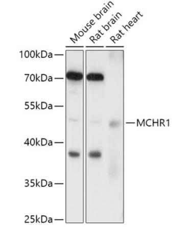 MCHR1 Rabbit Polyclonal Antibody