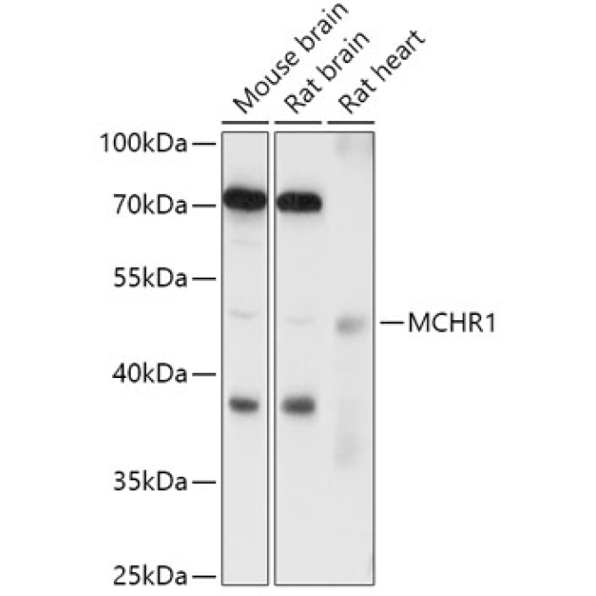 MCHR1 Rabbit Polyclonal Antibody