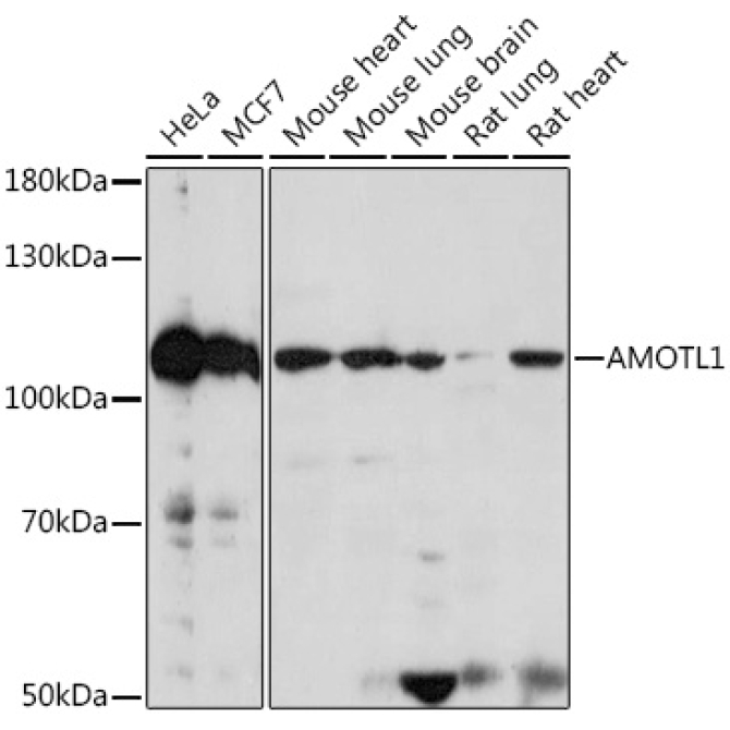 AMOTL1 Rabbit Polyclonal Antibody