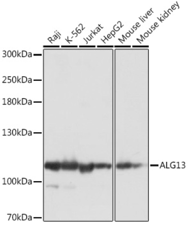 ALG13 Rabbit Polyclonal Antibody