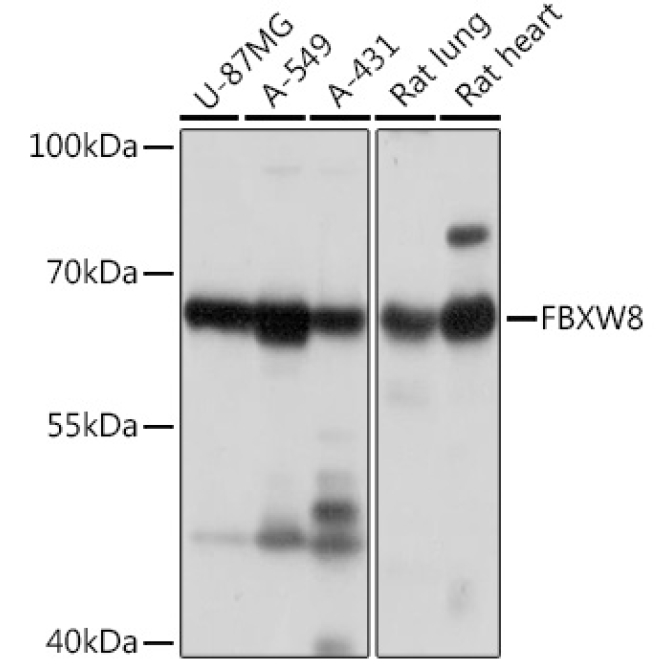 FBXW8 Rabbit Polyclonal Antibody