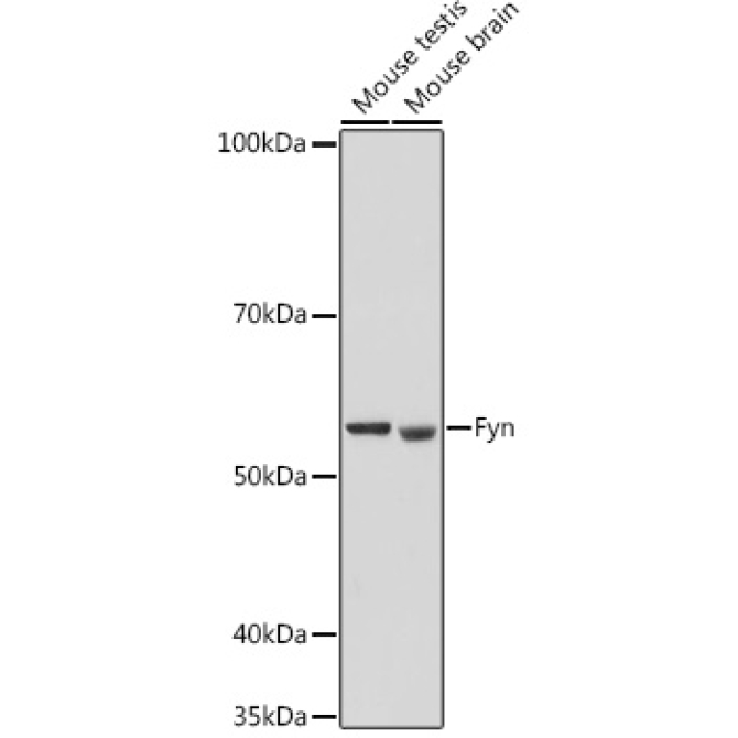 Fyn Rabbit Polyclonal Antibody