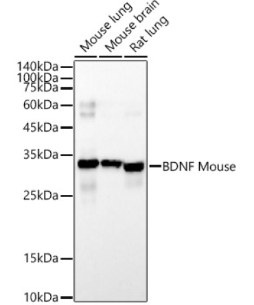 BDNF Mouse Monoclonal Antibody