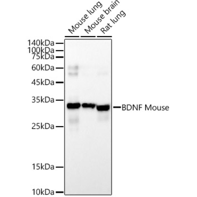 BDNF Mouse Monoclonal Antibody