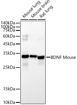 BDNF Mouse Monoclonal Antibody