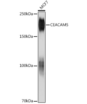 CEACAM5 Mouse Monoclonal Antibody