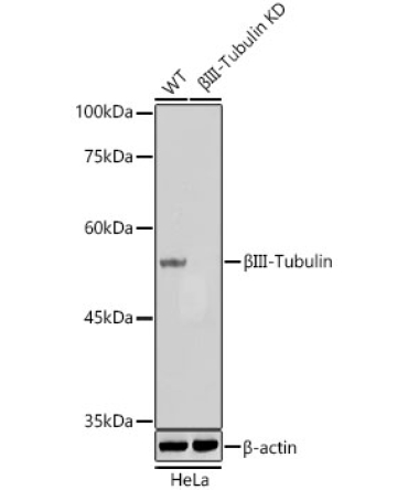 BetaIII-Tubulin Mouse Monoclonal Antibody [KD Validated]