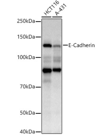 E-Cadherin Mouse Monoclonal Antibody