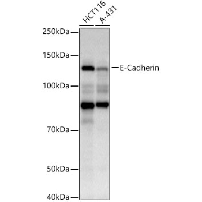 E-Cadherin Mouse Monoclonal Antibody