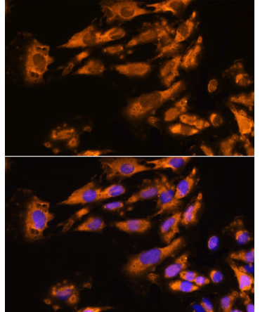 ASPM Rabbit Polyclonal Antibody