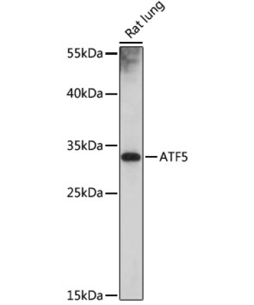 ATF5 Rabbit Polyclonal Antibody