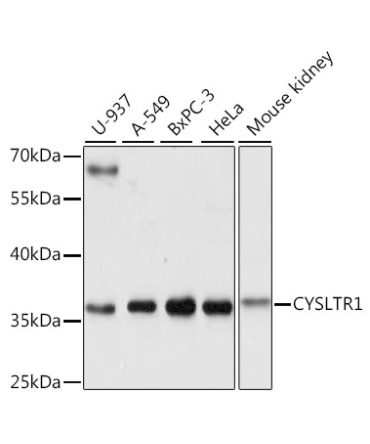 CYSLTR1 Rabbit Polyclonal Antibody