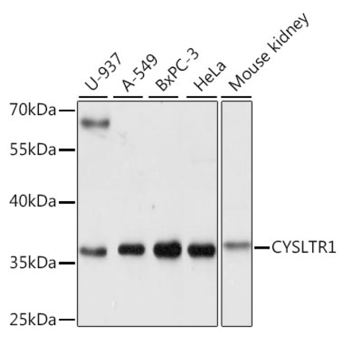 CYSLTR1 Rabbit Polyclonal Antibody