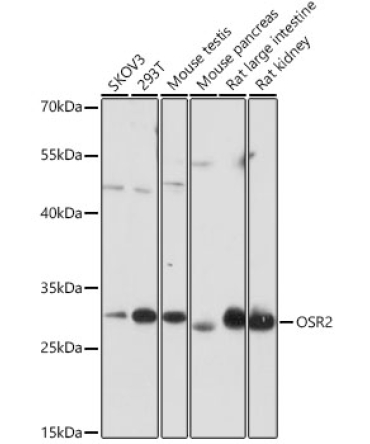 OSR2 Rabbit Polyclonal Antibody