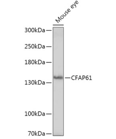 CFAP61 Rabbit Polyclonal Antibody