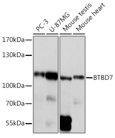 BTBD7 Rabbit Polyclonal Antibody