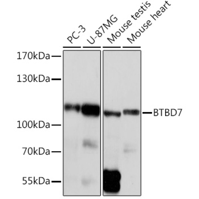 BTBD7 Rabbit Polyclonal Antibody