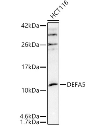 DEFA5 Rabbit Polyclonal Antibody